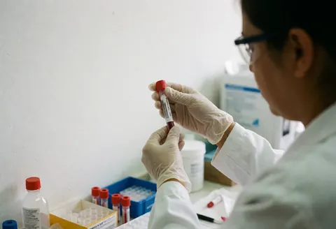 Un technicien en laboratoire clinique manipule un tube contenant du sang, portant des gants et des lunettes de protection dans un environnement professionnel.