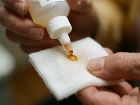 Gouttes de solution antiseptique tombant sur une compresse blanche, mains appliquant le produit, fond flou et éclairage naturel pour la podologie.