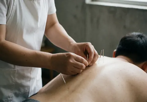 Un praticien effectue un traitement d'acupuncture sur le dos d'un patient, avec les mains et les aiguilles visibles dans un cadre professionnel.
