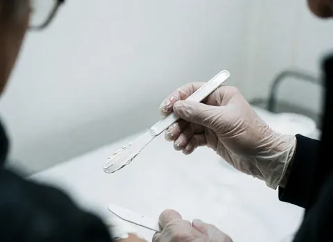 Gant stérile appliquant une crème anesthésique avec une spatule sur une surface blanche, éclairage froid et propre, détail macro d'un outil médical.