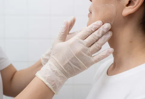 Une main portant un gant stérile applique du gel de traitement sur la zone du menton d'une cliente, devant un fond de carreaux blancs.