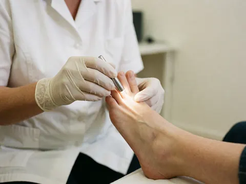 Un podologue en uniforme blanc et gants examine attentivement le pied d'un patient à l'aide d'une lampe médicale dans un cabinet de soins.